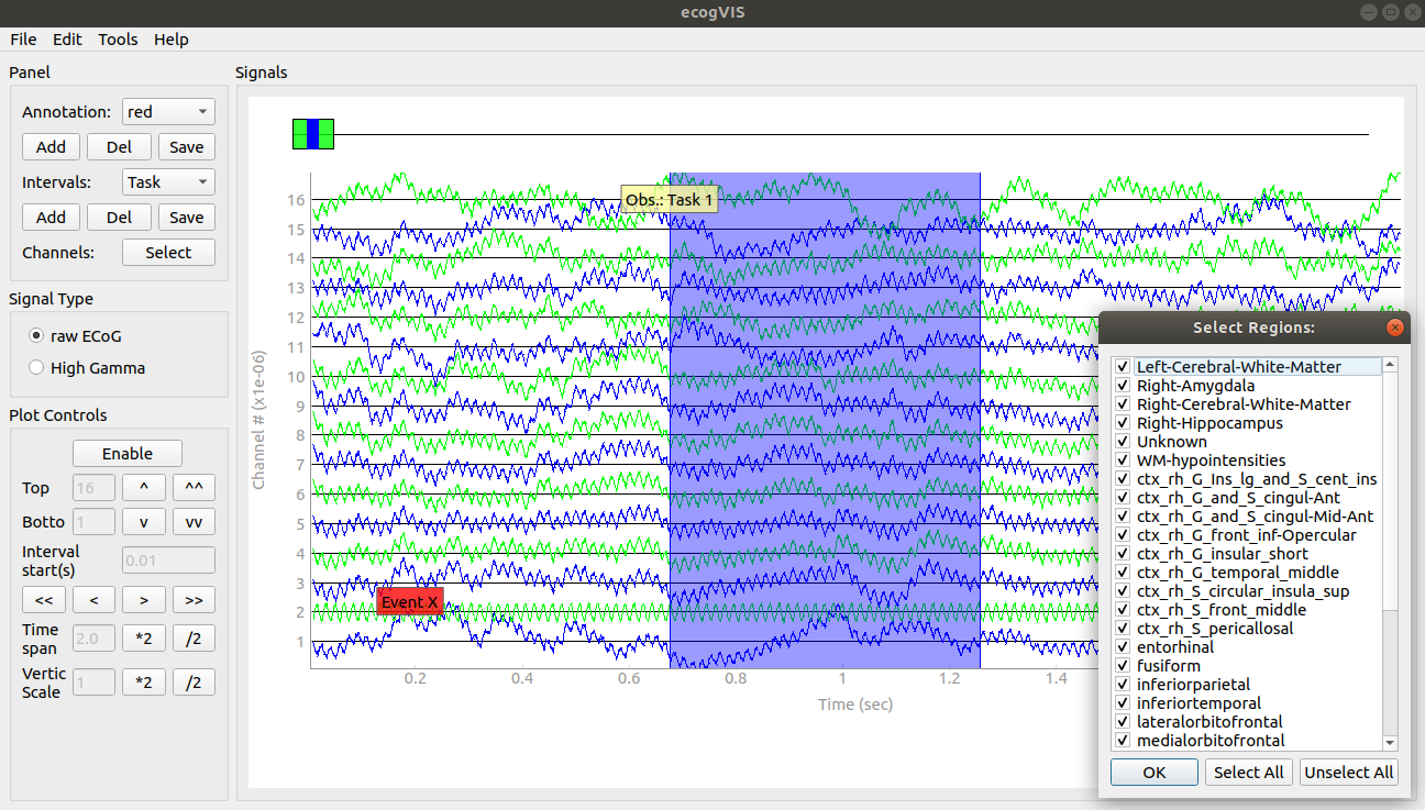 EcogVIS Screenshot