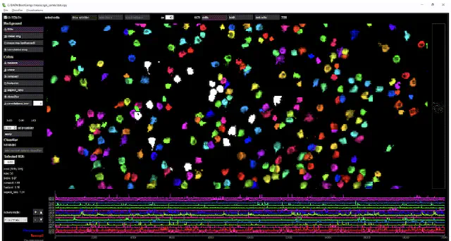 Suite2p